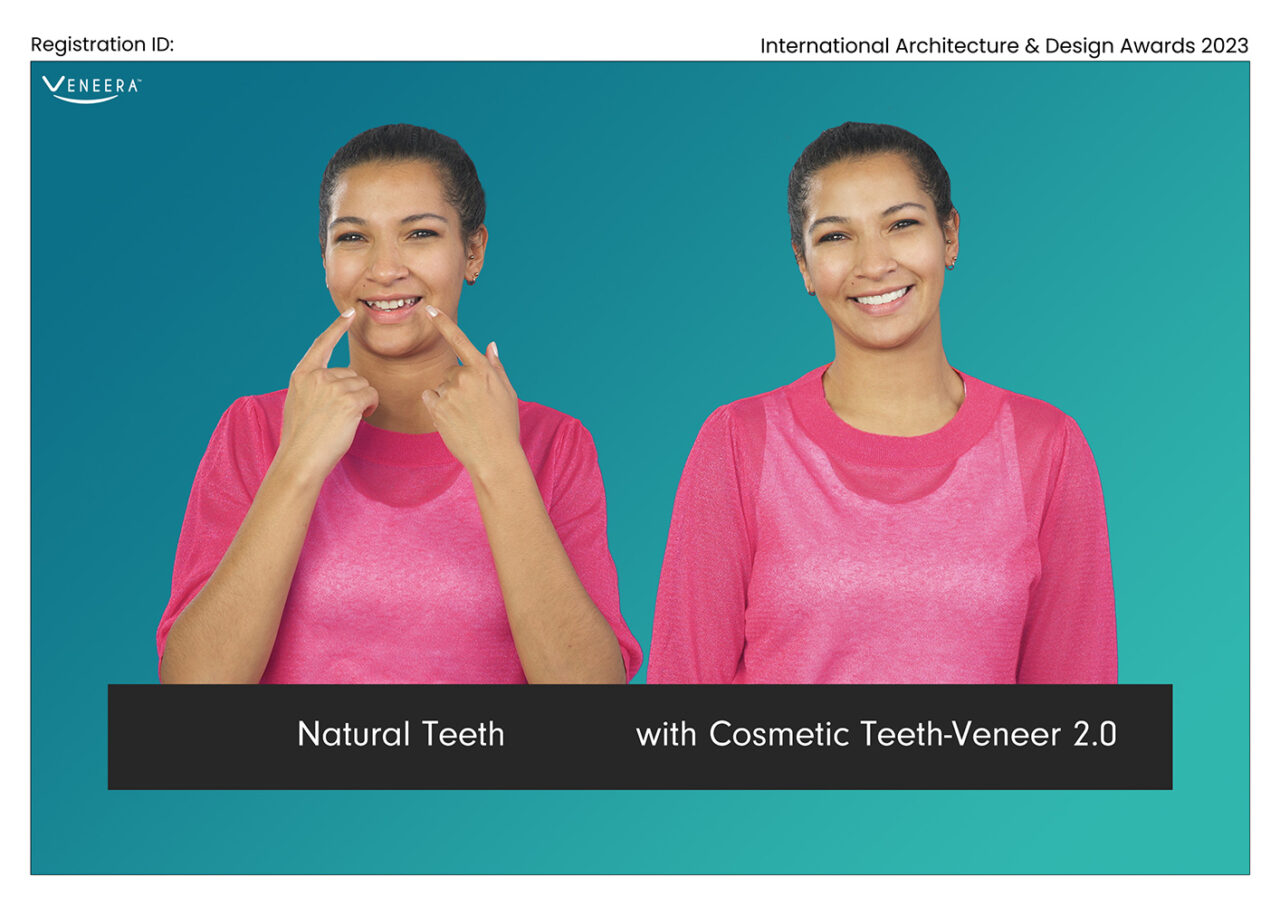 Cosmetic Teeth-Veneer 2.0